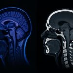 Diferencia entre resonancia magnética y tomografía computarizada, cuándo se utiliza cada estudio diferencias entre resonancia magnética y tomografía computarizada